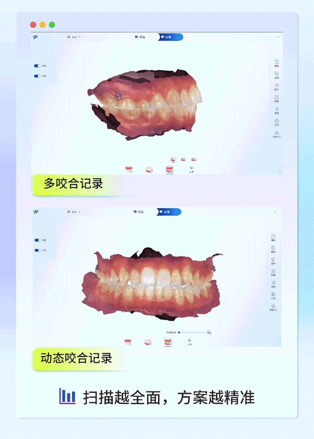 正畸_05.gif